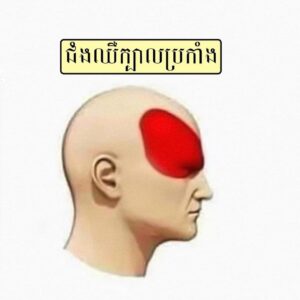 ប្រភេទនៃការឈឺក្បាល