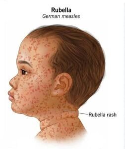 រវាងស្អូច-កញ្ជ្រឹល ខុស និងដូចគ្នាម៉េចខ្លះ?