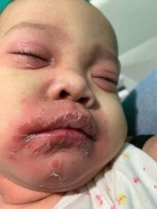 នេះជាហេតុផលដែលអ្នកគួរជៀសវាងការថើបទារក។  មាត់របស់មនុស្សពេញវ័យអាចផ្ទុកបាក់តេរី ឬមេរោគជាច្រើន