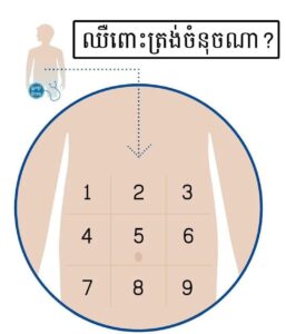 កន្លែងដែលឈឺនៅក្នុងពោះ អាចបង្ហាញពីមូលហេតុនៃការឈឺ។